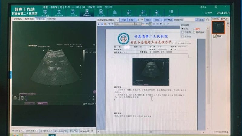 女性备孕检查费用为什么差这么多